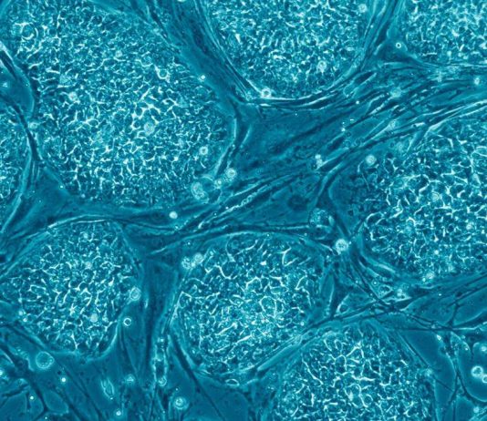 Recherche : Le potentiel des cellules souches