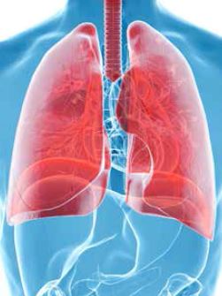 Réveiller le système immunitaire du patient