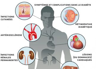 Diabète: faire face au « tsunami sanitaire »