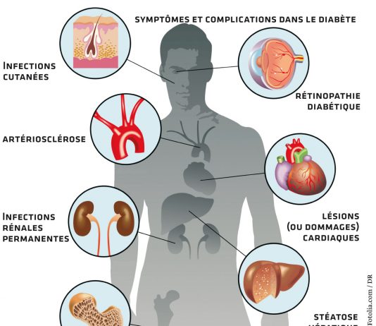 Diabète: faire face au « tsunami sanitaire »