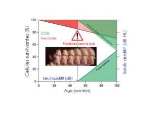 Ralentir la presbyacousie liée à l’âge