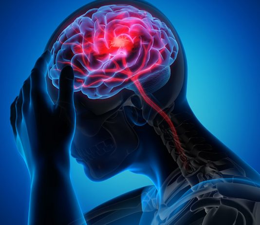 AVC : gagner la course contre la montre