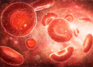 CHANGEMENT DE PARADIGME DANS LA PRISE EN CHARGE DE L’HEMOPHILIE