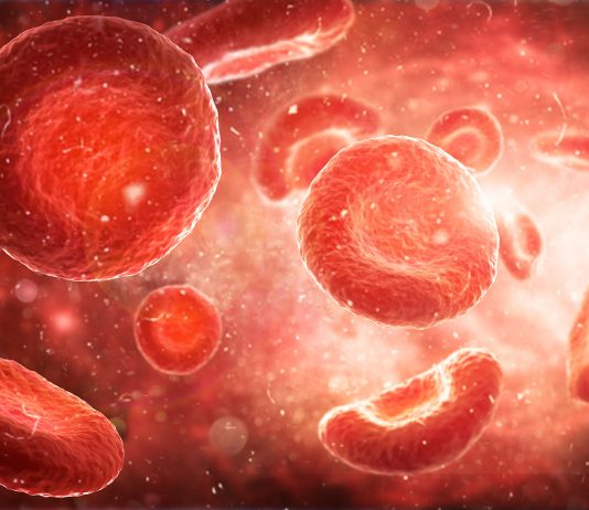 CHANGEMENT DE PARADIGME DANS LA PRISE EN CHARGE DE L’HEMOPHILIE