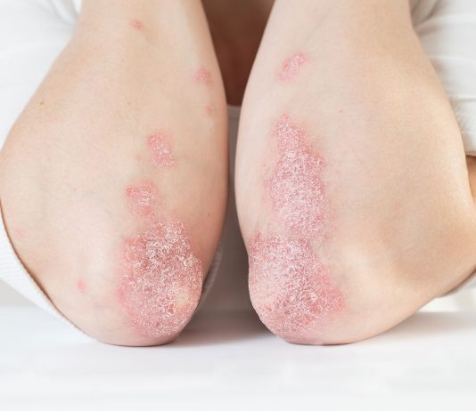 MOBILISES POUR REPONDRE AUX BESOINS MEDICAUX NON COUVERTS