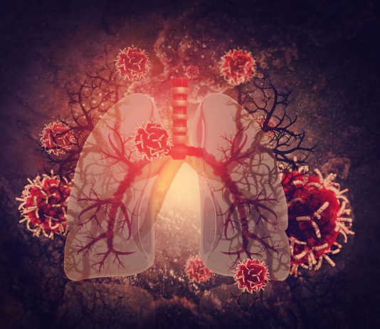 LA PNEUMOLOGIE EN PREMIÈRE LIGNE