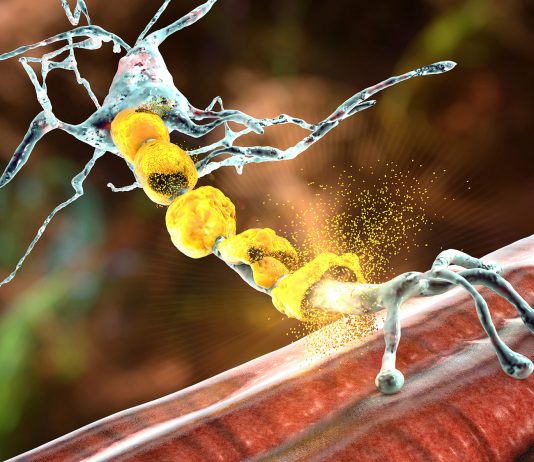 Un tournant majeur dans la prise en charge de la sclérose en plaques (SEP)