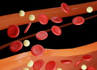 Hémophilie : les promesses de l’innovation