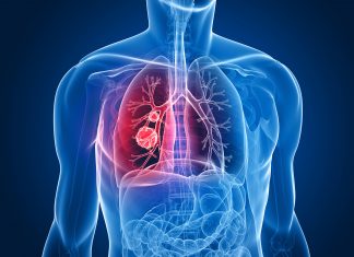 Le progrès thérapeutique s’accélère