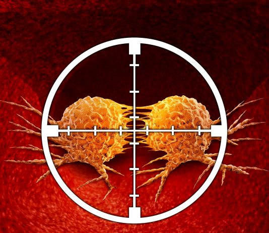 Cancer : des progrès pour de nouveaux espoirs