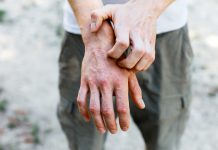 Dermatologie : de nouveaux espoirs pour les patients