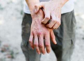 Dermatologie : de nouveaux espoirs pour les patients