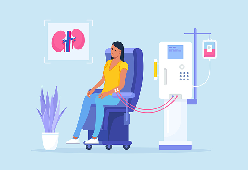 Tout savoir sur la (les) dialyse (s) 1 dialyse AdobeStock 465775433