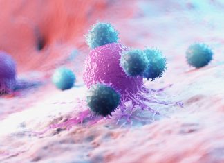 Cancer : les leviers du progrès