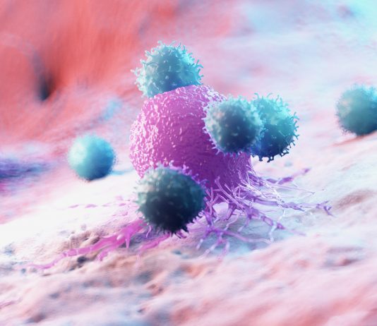 Cancer : les leviers du progrès