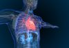 Cardiologie, la mère des batailles