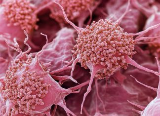 Hématologie : de nouvelles perspectives pour les patients