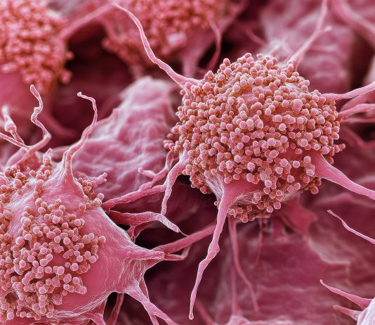 Hématologie : de nouvelles perspectives pour les patients