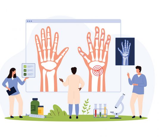 Rhumatologie : l’innovation en marche