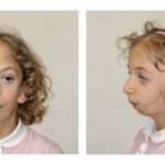 Réduire l’errance diagnostique des maladies rares par l’IA